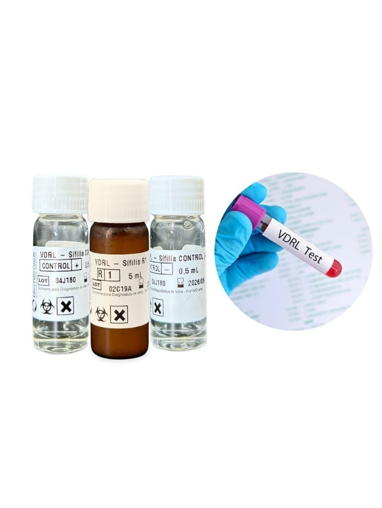 VDRL Pronto com 250 testes 